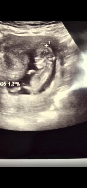 Bild zu NUB THERAPIE - Forum für Juni - Mamis