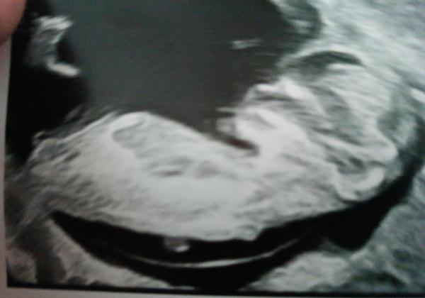 Bild zu Nub Methode - Forum für Juni - Mamis