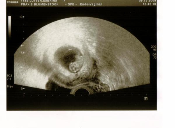 Bild zu wollte mich mal vorstellen und mein kleines würmchen :-) - Forum für Juli - Mamis