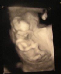 Bild zu Unser erstes Mal Baby-TV - Forum für Juli - Mamis