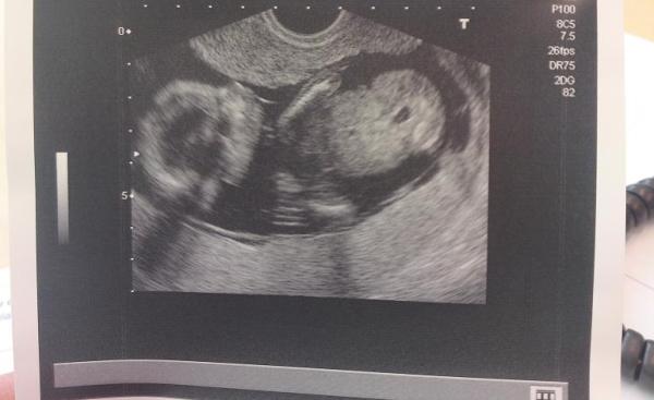 Bild zu VU gestern und Outing - bin soooo glücklich!! - Forum für Juli - Mamis