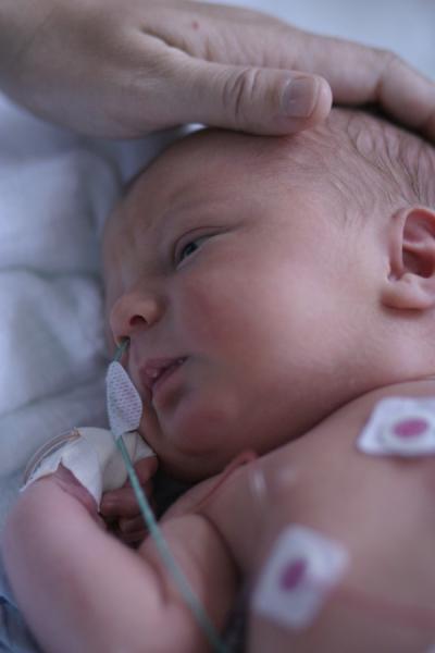Bild zu Ein Jahr liegt zwischen diesen bildern... - Forum für Juli - Mamis