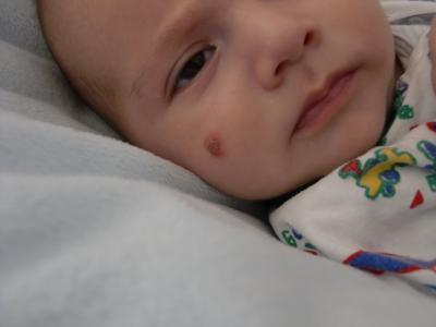 Bild zu was kann das sein? - Forum für Juli - Mamis