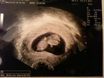 Bild zu Baby - TV! Sooo schön! - Forum für Juli - Mamis