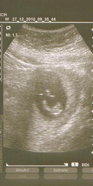 Bild zu Hallo Mädels... - Forum für Juli - Mamis