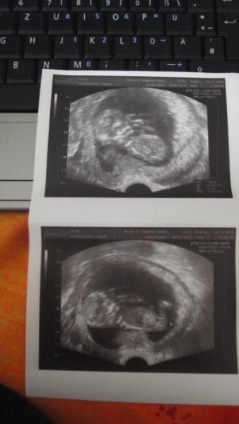 Bild zu Heute VU gehabt, hier mein baby :-)))) - Forum für Juli - Mamis