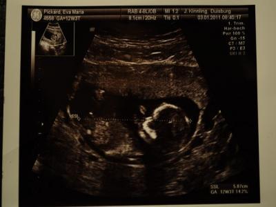 Bild zu Bauchfotos... Innen und außen :-) - Forum für Juli - Mamis