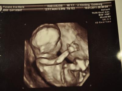 Bild zu VU gehabt 3D Foto .. *schaut mal* - Forum für Juli - Mamis
