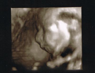 Bild zu 3D Bilder !!! - Forum für Juli - Mamis