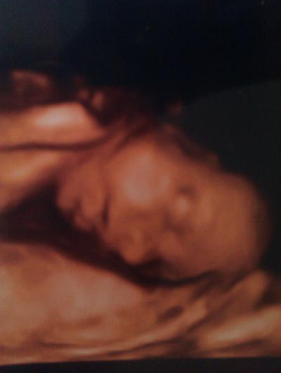 Bild zu 3d bild 26ssw - Forum für Juli - Mamis