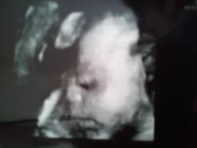 Bild zu zurück vom 3D ultraschall :) - Forum für Juli - Mamis