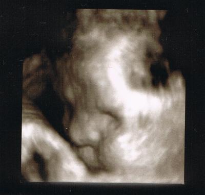 Bild zu Heute war wieder VU (mit Foto)... - Forum für Juli - Mamis