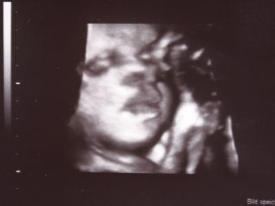 Bild zu Aktuelles Foto von unsrem Krümi - Forum für Juli - Mamis
