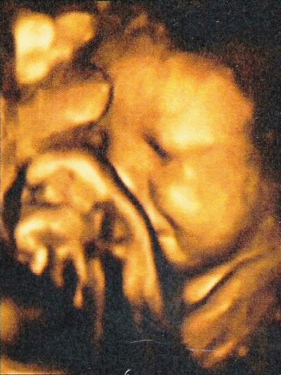 Bild zu Lebenszeichen und Bild - Forum für Juli - Mamis