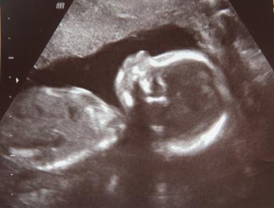 Bild zu Dann zählt doch mal durch... - Forum für Juli - Mamis