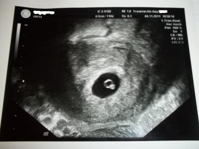 Bild zu Da ist es..... :-) - Forum für Juli - Mamis