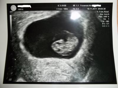Bild zu Ich muss umziehen!! darf ich trotzdem noch mit bei euch bleiben???? - Forum für Juli - Mamis