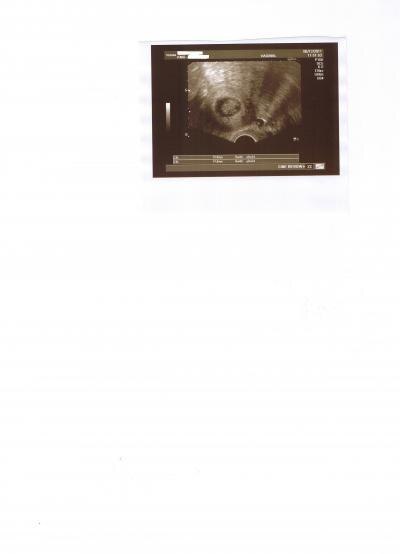 Bild zu 1. Ultraschallbild - Forum für Juli - Mamis