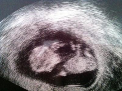 Bild zu Auch zurück :) - Forum für Juli - Mamis