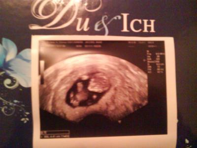 Bild zu mein kleines würmchen - Forum für Juli - Mamis