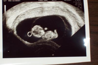 Bild zu noch ein FA- Bericht- von gestern ;) - Forum für Juli - Mamis