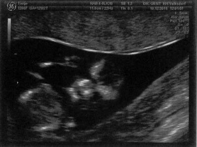 Bild zu Nachträglich noch 2 Bilder! - Forum für Juli - Mamis
