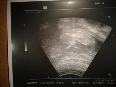 Bild zu Zurück vom Arzt ;-) - Forum für Juli - Mamis