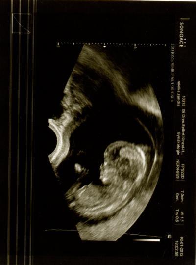 Bild zu FA Bericht - Forum für Juli - Mamis