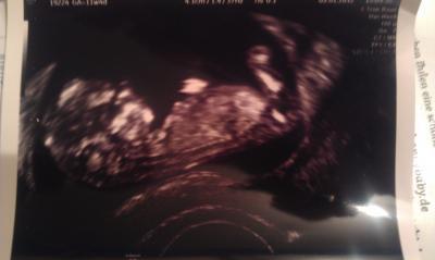 Bild zu Da ist sie wieder.... - Forum für Juli - Mamis