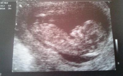 Bild zu Hab auch mal ein Bild von gestern angehängt :-) - Forum für Juli - Mamis