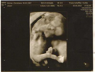 Bild zu Arztbericht vom Montag - Forum für Juli - Mamis