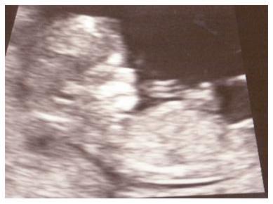 Bild zu Fotos 1 - Forum für Juli - Mamis