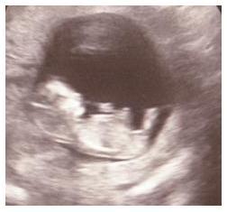 Bild zu Foto 3 - Forum für Juli - Mamis