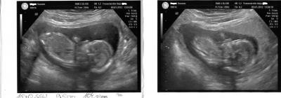 Bild zu Bericht vom Frauenarzt + Fotos - Forum für Juli - Mamis