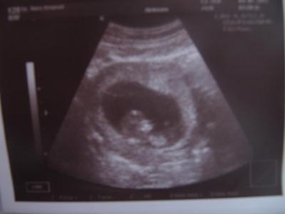 Bild zu meen krümmel vom 5.1.11 - Forum für Juli - Mamis