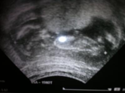 Bild zu zurück mit 90%igen Outing - Forum für Juli - Mamis