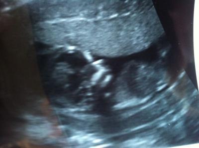 Bild zu Bild vom Krümel - Forum für Juli - Mamis