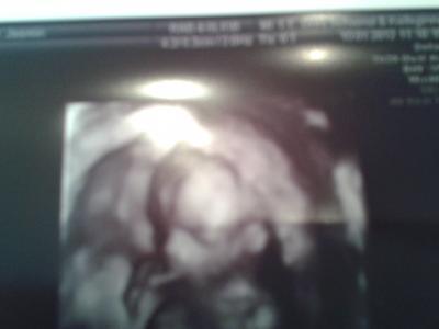 Bild zu huhu zurück von der FÄ - Forum für Juli - Mamis