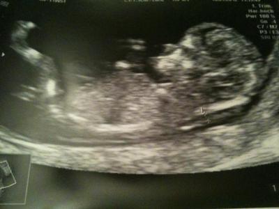 Bild zu Heute FA - Forum für Juli - Mamis