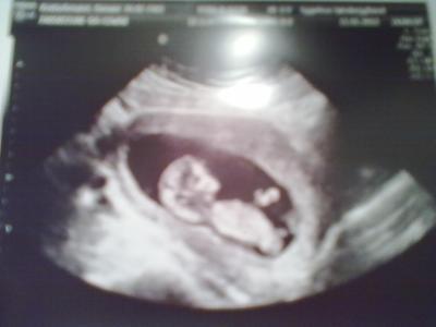 Bild zu War beim Ultraschall :-) - Forum für Juli - Mamis