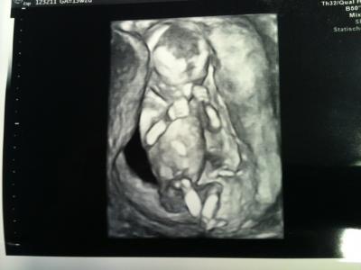 Bild zu Mein FA-Bericht - Forum für Juli - Mamis