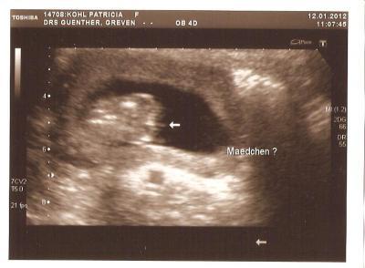 Bild zu heute Outing - Forum für Juli - Mamis