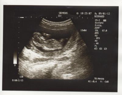 Bild zu Da ja jetzt die Bilder wieder gehen, schnell mein US-Bild :-) !!! - Forum für Juli - Mamis