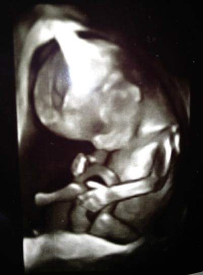 Bild zu Bericht vom FA mit Outing ;) - Forum für Juli - Mamis