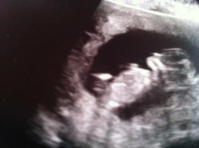 Bild zu schaut mal bitte - Forum für Juli - Mamis