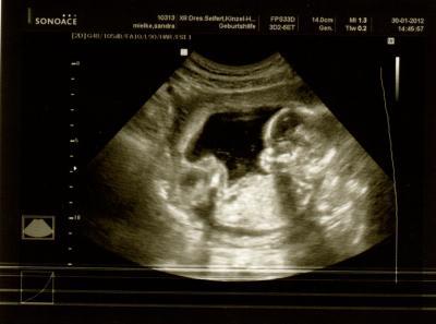 Bild zu FA Bericht - Forum für Juli - Mamis