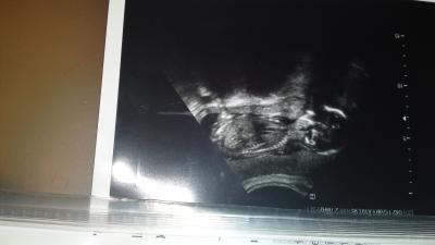 Bild zu neu hier und outing - Forum für Juli - Mamis