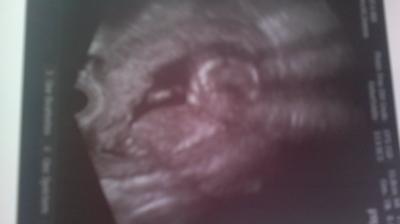 Bild zu wieder da vom fa - Forum für Juli - Mamis