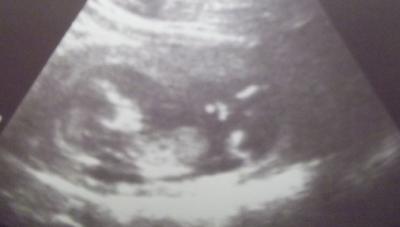 Bild zu Juhu heute bin ich ne 16 und Baby TV - Forum für Juli - Mamis