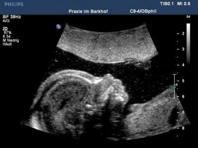 Bild zu FD heute mit Outing :o) - Forum für Juli - Mamis